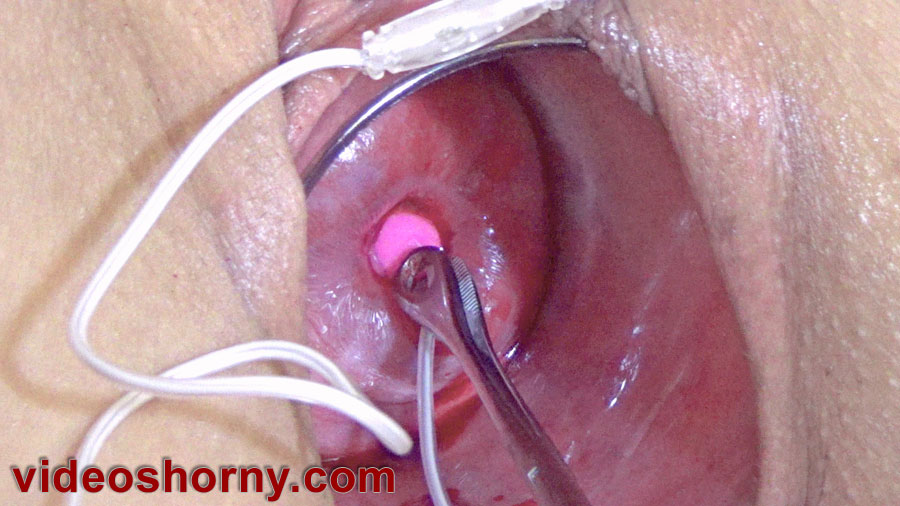 Insertion of japanese bullet vibrator in uterus