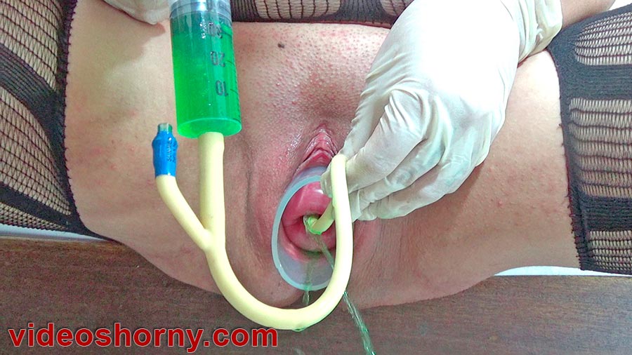 Cervix torture with the insertion of a catheter filled saline