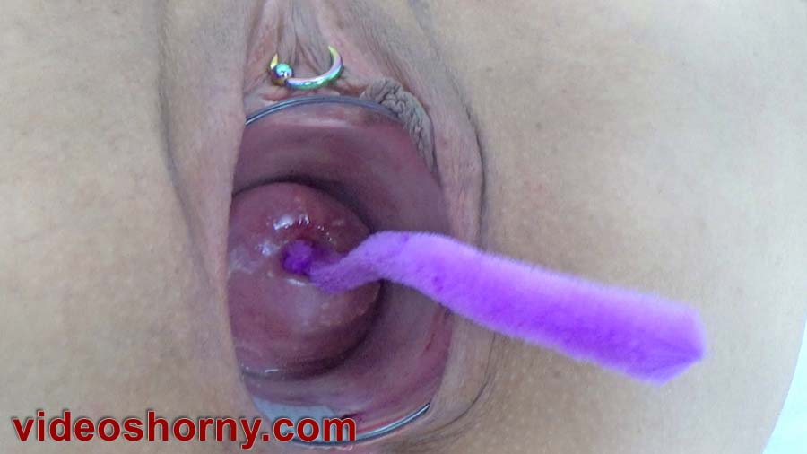 Stretching cervical canal with pipe cleaner brush