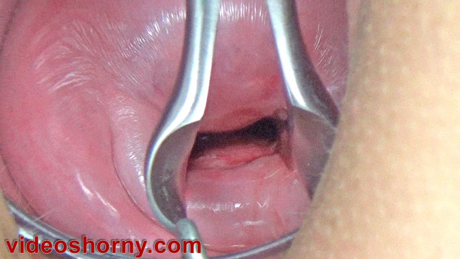 Cervix open wide with speculum for impregnation with injection of semen